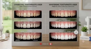 Illustration comparing teeth whitening results over time between charcoal and whitening toothpaste
